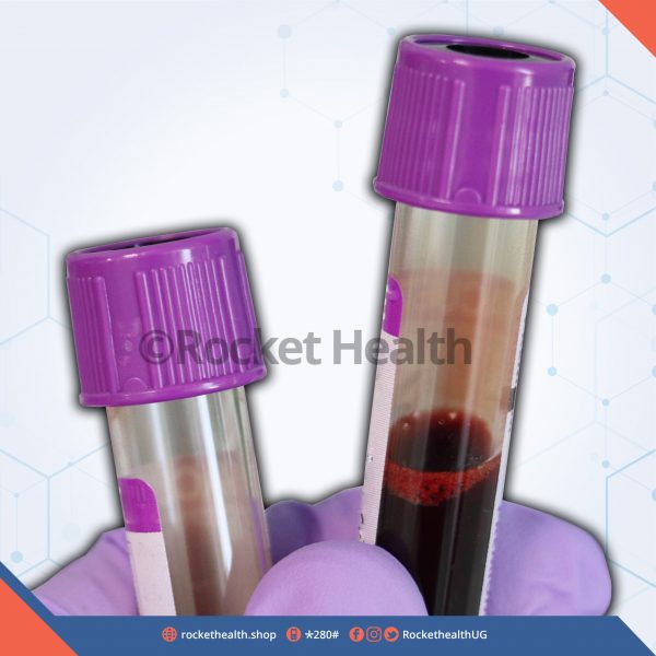 Glycosylated Haemoglobin test (HbA1c