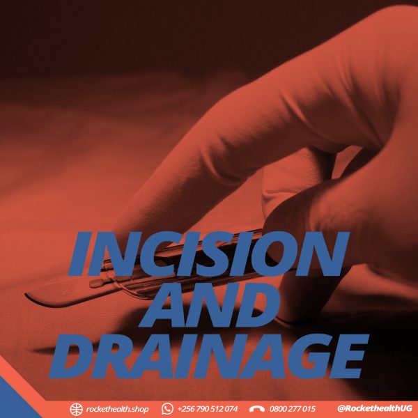INCISION AND DRAINAGE