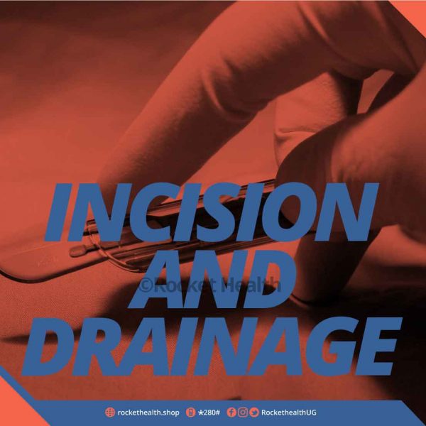 Incision-and-Drainage-(I&D)