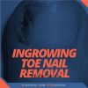 Ingrowing-Toe-Nail-Removal