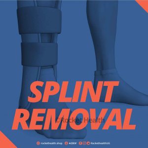 Splint-Removal